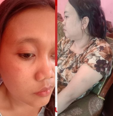 2 Wanita Teraniaya